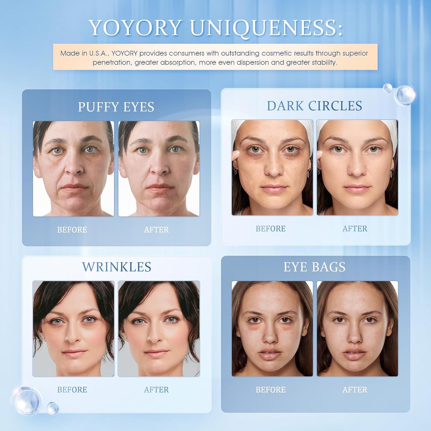YOYORY Under Eye Patches Masks - for Eye Bags, Puffy Eyes, Wrinkles, Fine Lines, Dark Circles Treatment with Collagen and Hyaluronic Acid, Moisturizing and Hydrating - 60 Pcs
